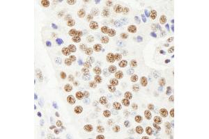 Immunohistochemistry (IHC) image for anti-Ras-Related GTP Binding A (RRAGA) (AA 544-594) antibody (ABIN7448966) (RRAGA anticorps  (AA 544-594))