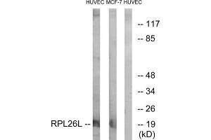 Western blot analysis of extracts from HUVEC cells and MCF-7 cells, using RPL26L antibody. (RPL26L anticorps  (C-Term))
