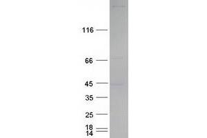 Validation with Western Blot