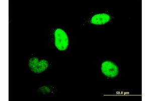 Immunofluorescence of monoclonal antibody to RNUT1 on HeLa cell.