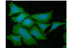 ICC/IF analysis of GSTT2 in HeLa cells line, stained with DAPI (Blue) for nucleus staining and monoclonal anti-human GSTT2 antibody (1:100) with goat anti-mouse IgG-Alexa fluor 488 conjugate (Green).