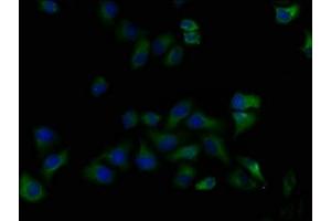 Immunofluorescence staining of Hela cells with ABIN7139916 at 1:50, counter-stained with DAPI.