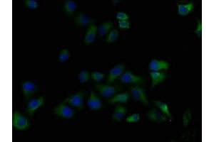 Immunofluorescence staining of Hela cells with ABIN7139916 at 1:50, counter-stained with DAPI. (LPAR5 anticorps  (AA 310-326))