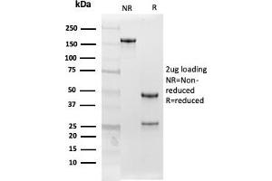 SDS-PAGE Analysis Purified Follistatin Mouse Monoclonal Antibody (FST/4282). (Follistatin anticorps)