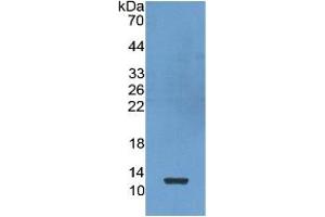 WB of Protein Standard: different control antibodies against Highly purified E. (CXCL7 Kit ELISA)