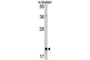 Western blot analysis of RAB13 antibody (Center) in mouse bladder tissue lysates (35ug/lane). (RAB13 anticorps  (Middle Region))