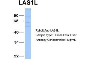 Host:  Rabbit  Target Name:  LAS1L  Sample Type:  Human Fetal Liver  Antibody Dilution:  1. (LAS1L anticorps  (Middle Region))