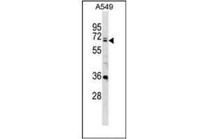 Western blot analysis of DDX28 Antibody (DDX28 anticorps  (C-Term))