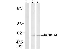 Western blot analysis of extract from H (Ephrin B2 anticorps)
