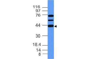 Image no. 1 for anti-Meis Homeobox 1 (MEIS1) (AA 163-352) antibody (ABIN5027352) (MEIS1 anticorps  (AA 163-352))