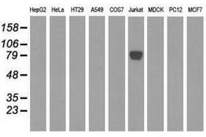 Image no. 3 for anti-EPM2A (Laforin) Interacting Protein 1 (EPM2AIP1) antibody (ABIN1498043) (EPM2AIP1 anticorps)