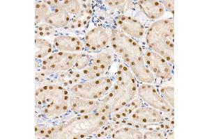 Immunohistochemistry of paraffin-embedded mouse kidney using Phospho-Smad2-S465/467 + Smad3-S423/425 Rabbit pAb (ABIN6135314, ABIN6136248, ABIN6136249 and ABIN6225575) at dilution of 1:50 (40x lens). (SMAD2 / SMAD3 (pSer423), (pSer425) anticorps)