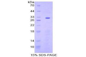 SDS-PAGE (SDS) image for Ectonucleoside Triphosphate diphosphohydrolase 1 (ENTPD1) (AA 98-352) protein (His tag) (ABIN2124693)