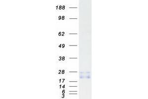 Validation with Western Blot