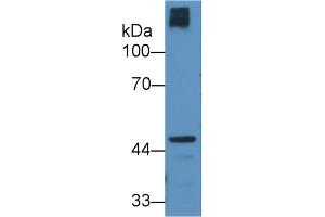 Detection of CRTAP in Human Hela cell lysate using Polyclonal Antibody to Cartilage Associated Protein (CRTAP) (CRTAP anticorps  (AA 26-400))