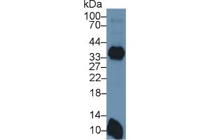 Detection of HLA-DRB1 in Mouse Spleen lysate using Polyclonal Antibody to HLA Class II Histocompatibility Antigen, DRB1 Beta Chain (HLA-DRB1) (HLA-DRB1 anticorps  (AA 27-264))