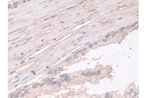 Detection of PGM1 in Human Prostate Tissue using Polyclonal Antibody to Phosphoglucomutase 1 (PGM1)