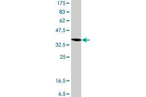 Western Blot detection against Immunogen (37. (RPS3A anticorps  (AA 164-263))