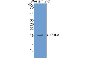 Western blot analysis of the recombinant protein. (CLIC4 anticorps  (AA 104-253))