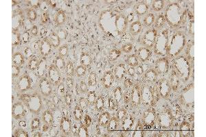 Immunoperoxidase of monoclonal antibody to EXOSC3 on formalin-fixed paraffin-embedded human kidney.
