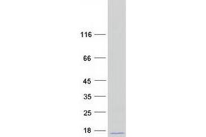 Validation with Western Blot