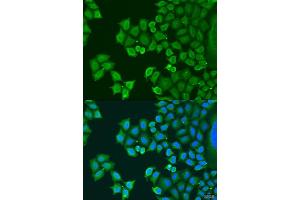 anti-Synaptotagmin IV (SYT4) (AA 38-190) antibody