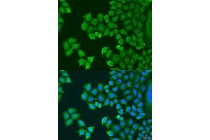 Immunofluorescence analysis of U2OS cells using SYT4 antibody (ABIN6129135, ABIN6148791, ABIN6148792 and ABIN6223676) at dilution of 1:100. (SYT4 anticorps  (AA 38-190))