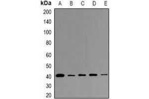 Western blot analysis of LPAAT gamma expression in K562 (A), A549 (B), PC12 (C), mouse testis (D), rat testis (E) whole cell lysates. (AGPAT3 anticorps)