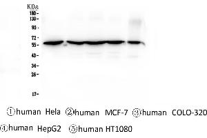 Western blot analysis of CCT3 using anti-CCT3 antibody . (CCT3 anticorps  (C-Term))