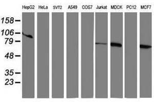 Image no. 1 for anti-Ribophorin 1 (RPN1) antibody (ABIN1500753)