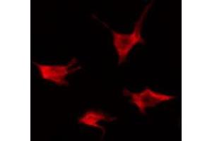 ABIN6274247 staining Hela by IF/ICC. (ACVRL1 anticorps  (Internal Region))