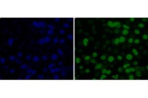Immunofluorescence analysis of 293T cells using MonoMethyl-Histone H3-K36 Polyclonal Antibody (Histone 3 anticorps  (meLys36))