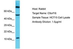 Image no. 1 for anti-Chromosome 9 Open Reading Frame 16 (C9orf16) (C-Term) antibody (ABIN6750667) (C9orf16 anticorps  (C-Term))