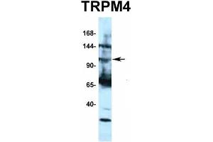 Host:  Rabbit  Target Name:  TRPM4  Sample Type:  HepG2  Antibody Dilution:  1.