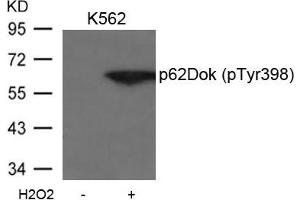 Western blot analysis of extracts from K562 cells untreated or treated with H2O2 using p62Dok(phospho-Tyr398) Antibody. (DOK1 anticorps  (pTyr398))