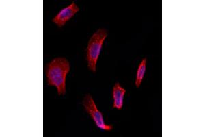 ABIN6261615 and ABIN6273239 staining Hela by IF/ICC.