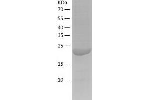 Western Blotting (WB) image for Survival Motor Neuron Domain Containing 1 (SMNDC1) (AA 1-238) protein (His-IF2DI Tag) (ABIN7125261)