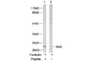 Image no. 2 for anti-BCL2-Associated Agonist of Cell Death (BAD) (Ser112) antibody (ABIN197208) (BAD anticorps  (Ser112))