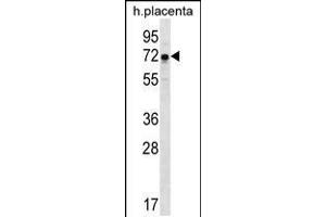 Western blot analysis in human placenta tissue lysates (35ug/lane). (GNE anticorps  (N-Term))