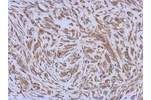 IHC-P Image Immunohistochemical analysis of paraffin-embedded U373 xenograft, using ENTPD3, antibody at 1:500 dilution.