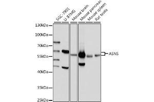 Western blot analysis of extracts of various cell lines, using ASNS antibody (ABIN7265693) at 1:1000 dilution. (Asparagine Synthetase anticorps  (AA 262-561))