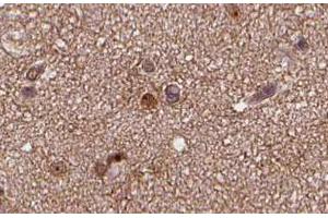 ABIN6266635 at 1/100 staining human brain tissue sections by IHC-P. (SNAP25 anticorps  (C-Term))