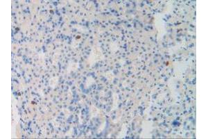 Figure. (Dynamin 1 anticorps  (AA 572-745))