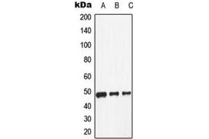 Western blot analysis of Dopamine Receptor D1 expression in HeLa (A), NIH3T3 (B), H9C2 (C) whole cell lysates. (Dopamine Receptor d1 anticorps  (Center))