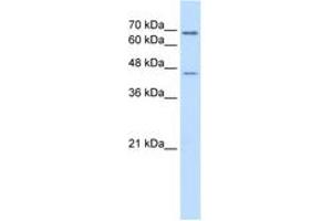 Image no. 2 for anti-Aldehyde Dehydrogenase 3 Family, Member A2 (ALDH3A2) (AA 351-400) antibody (ABIN6736668) (ALDH3A2 anticorps  (AA 351-400))