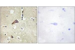 Immunohistochemistry analysis of paraffin-embedded human brain, using NMDAR1 (Phospho-Ser896) Antibody.