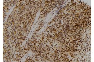 ABIN6274773 at 1/100 staining Rat spleen tissue by IHC-P. (RPL23 anticorps  (C-Term))