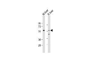 All lanes : Anti-SCP2 Antibody (Center) at 1:500-2000 dilution Lane 1: Mouse liver tissue lysate Lane 2: Rat liver tissue lysate Lysates/proteins at 20 μg per lane.