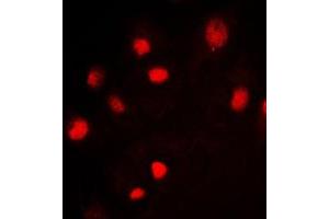Immunofluorescent analysis of MCM2 staining in Jurkat cells. (MCM2 anticorps  (N-Term))