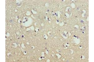 Immunohistochemistry of paraffin-embedded human brain tissue using ABIN7165209 at dilution of 1:100 (CNIH2 anticorps  (AA 94-138))